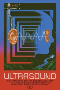 Ultrasound izle